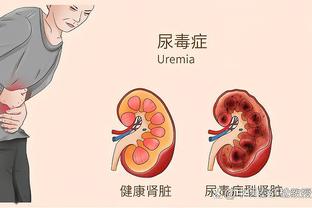 TA：范德贝克的租借合同中含买断条款，费用1100万欧